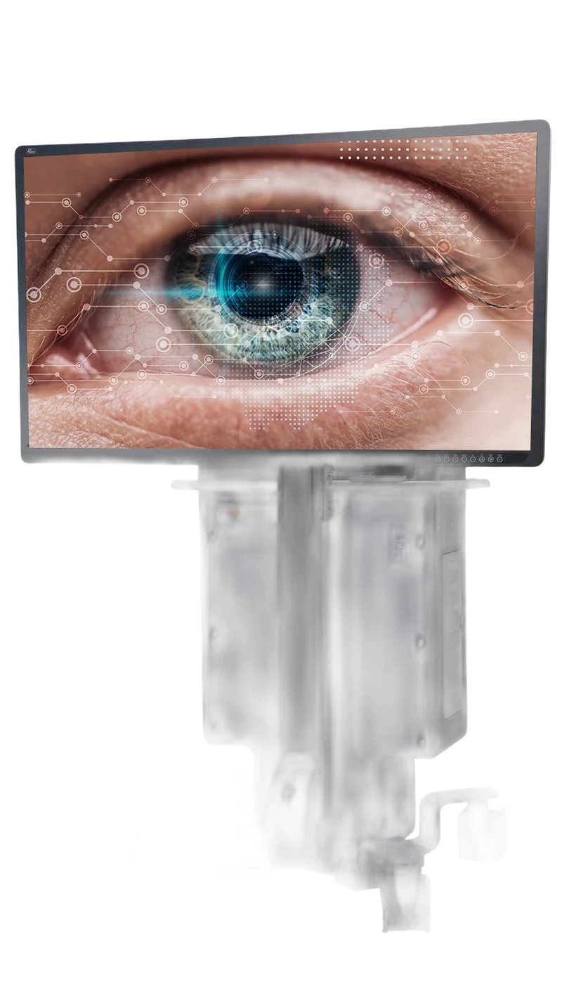 NGENUITY 3D Visualization System Alcon — Sistema de visualização digital 3D para cirurgia ocular