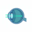 Ilustração de YAG Laser